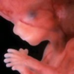 14 tyden 150x1501 150x150 Přání k narození miminka   neutrální   3. část